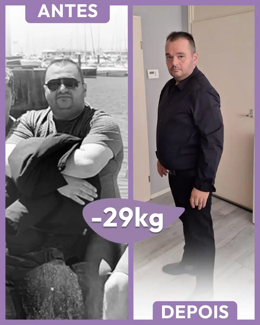 [NOVO] ANTES E DEPOIS 38