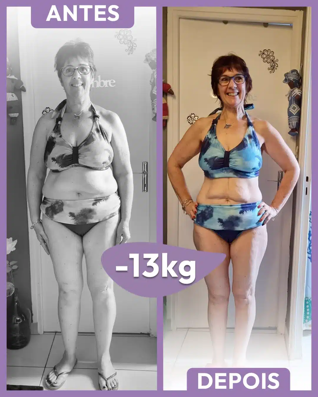 [NOVO] ANTES E DEPOIS 43